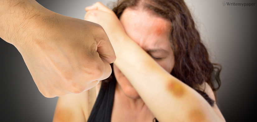 Bruises On Hand Bruises On Hand